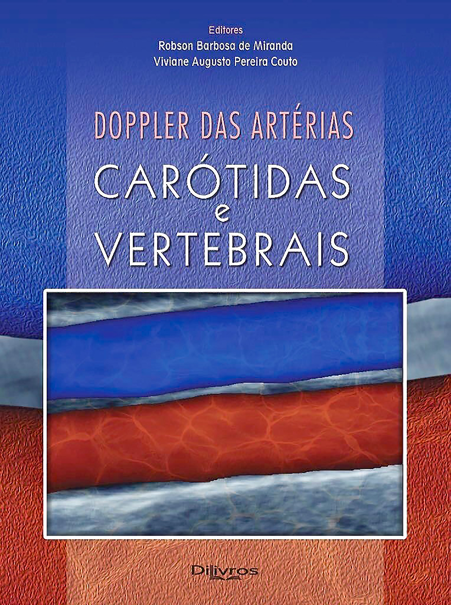 Capa do livro Doppler de Carótidas e Vertebrais